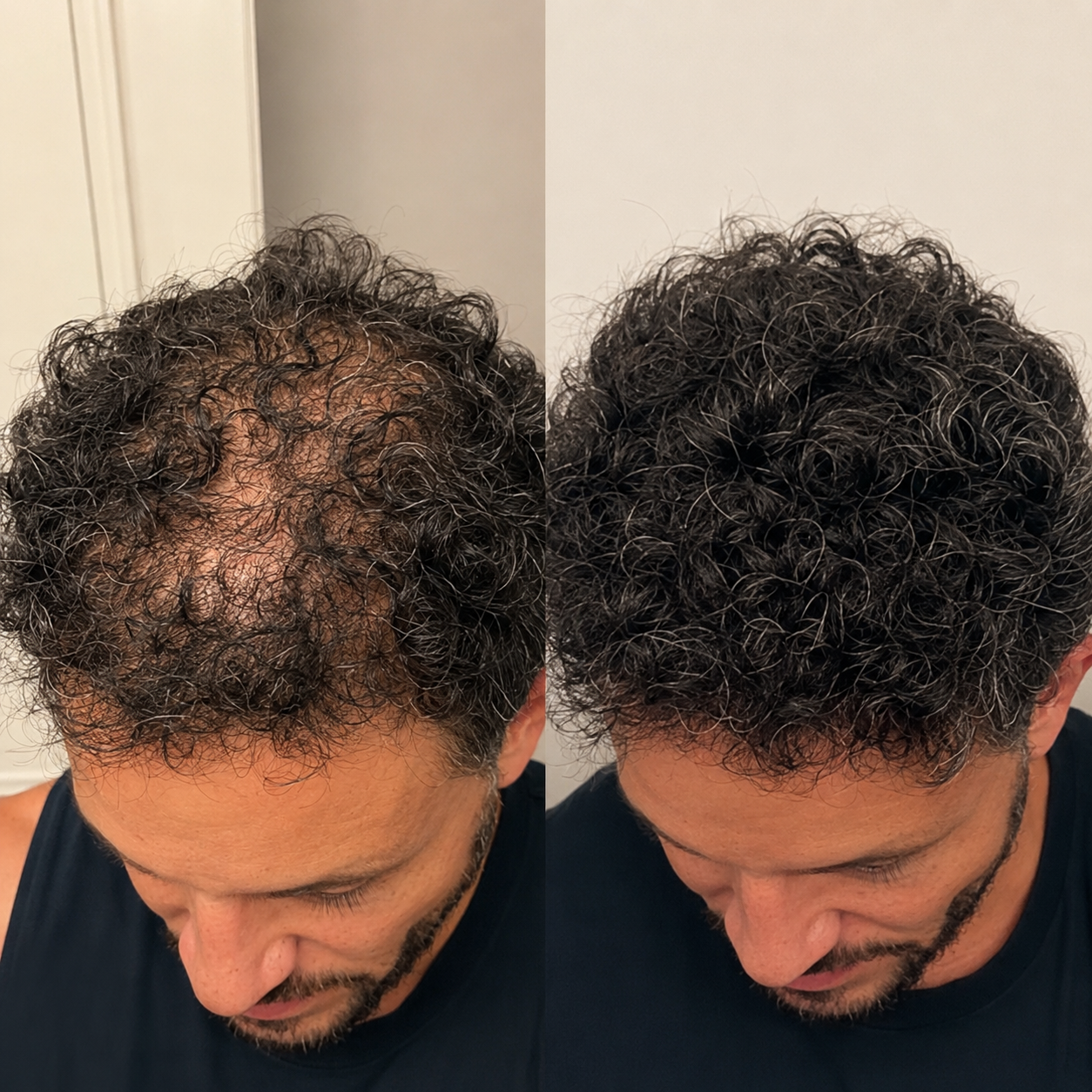 Before and after — Brandon S.